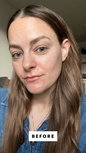 Allure content director Sophia Panych before applying the EltaMD UV Skin Recovery Red Color Correcting Green Tint SPF 50